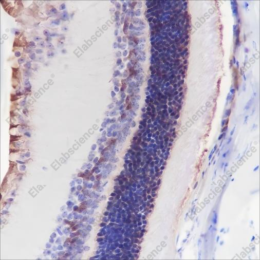 Recombinant CRALBP Monoclonal Antibody - 2