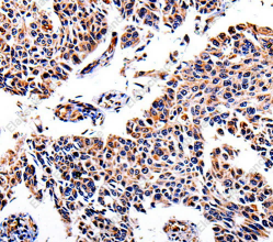 AKR1B1 Polyclonal Antibody - 2