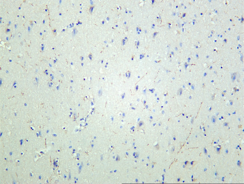 Recombinant TH/Tyrosine Hydroxylase Monoclonal Antibody - 2
