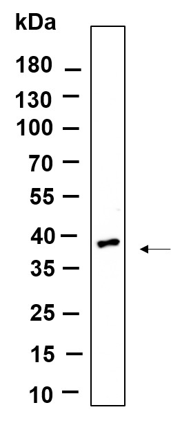 Recombinant OLIG2 Monoclonal Antibody-searchlist-1
