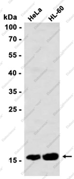 Recombinant SFT Monoclonal Antibody - 1