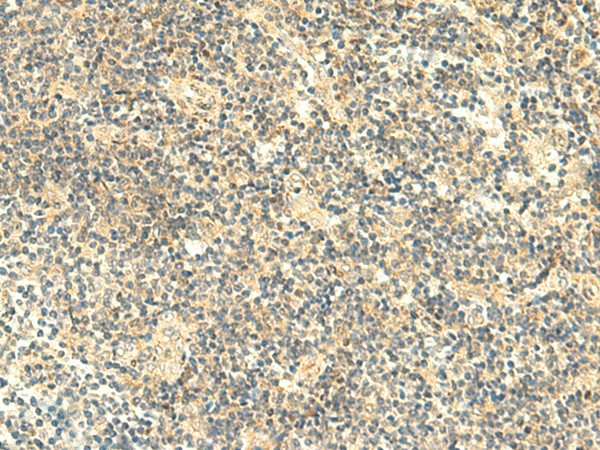 Immunohistochemistry of paraffin-embedded Human tonsil tissue  using HMBOX1 Polyclonal Antibody at dilution of 1:50(?200)