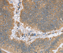 CANX Polyclonal Antibody - 2