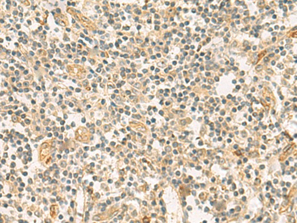 Immunohistochemistry of paraffin-embedded Human tonsil tissue  using HHIPL2 Polyclonal Antibody at dilution of 1:55(?200)