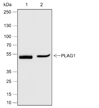 Recombinant PLAG1 Monoclonal Antibody - 2