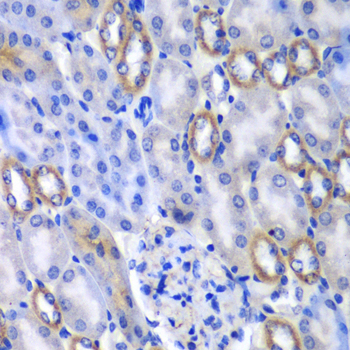 Immunohistochemistry of paraffin-embedded Mouse kidney using MATK Polyclonal Antibody at dilution of  1:100 (40x lens).