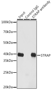 Immunoprecipitation analysis of 200ug extracts of HeLa cells using 3ug STRAP Polyclonal Antibody.Western blot was performed from the immunoprecipitate using STRAP Polyclonal Antibody at a dilution of 1:1000.