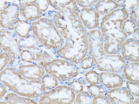 Immunohistochemistry of paraffin-embedded Rat kidney using Snail Polyclonal Antibody at dilution of  1:100 (40x lens).