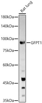 Western blot analysis of Rat lung using GFPT1 Polyclonal Antibody at 1:1000 dilution.