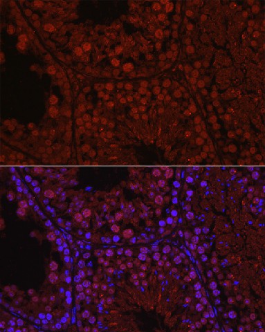 Immunofluorescence analysis of mouse testis using C1orf146 Polyclonal Antibody at dilution of 1:100 (40x lens). Blue: DAPI for nuclear staining.