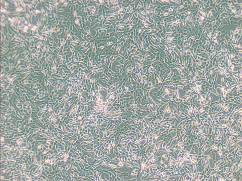 SUM159PT Cell Complete Medium - 3