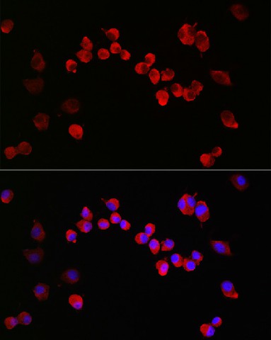 Immunofluorescence analysis of Neuro-2a cells using NMDAR1 Polyclonal Antibody at dilution of 1:200 (40x lens). Blue: DAPI for nuclear staining.