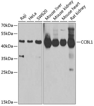 Western blot analysis of extracts of various cell lines using CCBL1 Polyclonal Antibody at 1:1000 dilution.