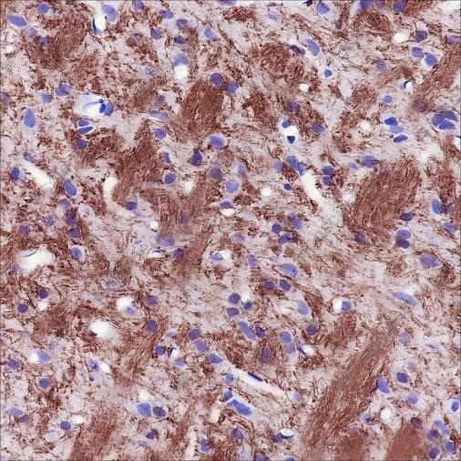 Recombinant MAG Monoclonal Antibody - 7