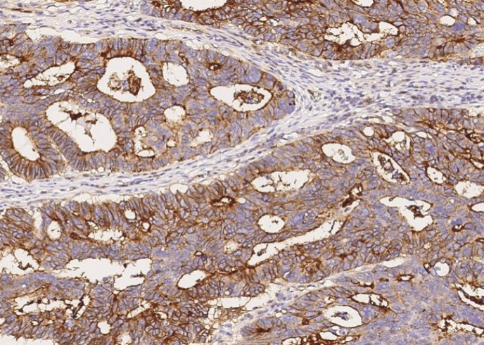 Recombinant IFITM1 Monoclonal Antibody - small - 2