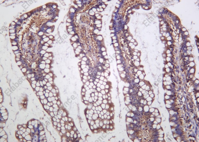 Recombinant Cystathionase Monoclonal Antibody - 1