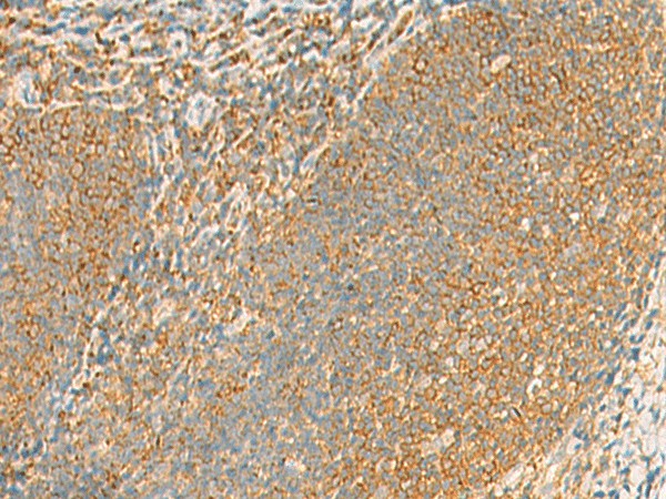 Immunohistochemistry of paraffin-embedded Human tonsil tissue  using GRIA4 Polyclonal Antibody at dilution of 1:60(?200)