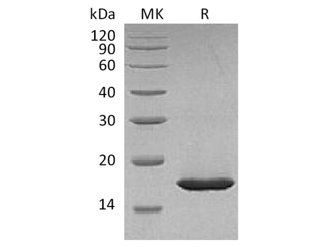 Recombinant Carassiusauratus Leptin Protein (His Tag)