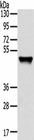 Western Blot analysis of Human fetal liver tissue using TRIM14 Polyclonal Antibody at dilution of 1/800