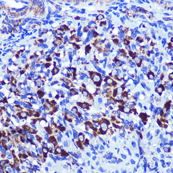 Immunohistochemistry of paraffin-embedded rat ovary using PALLD Polyclonal Antibody at dilution of 1:100 (40x lens).Perform microwave antigen retrieval with 10 mM PBS buffer pH 7.2 before commencing with IHC staining protocol.