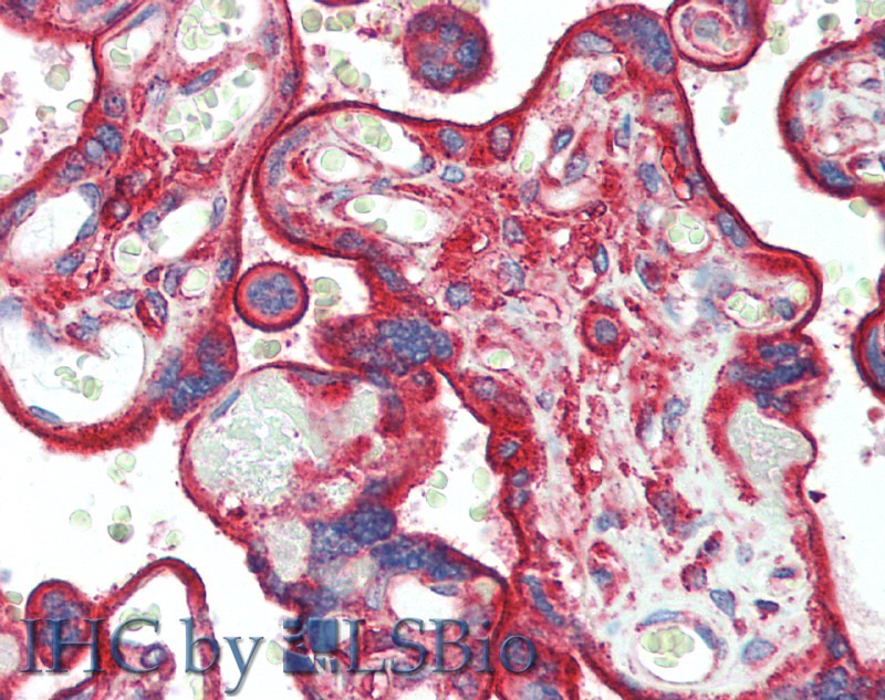 Immunohistochemistry of paraffin-embedded Placenta tissue using CLTC Polyclonal Antibody at dilution of 1:60(Elabscience Product Detected by Lifespan).