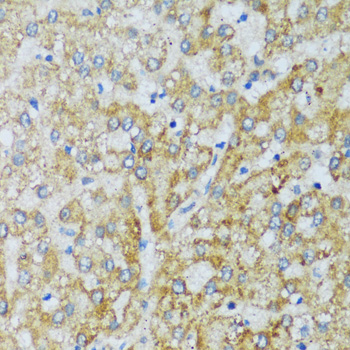 Immunohistochemistry of paraffin-embedded Human liver using C1QC Polyclonal Antibody at dilution of  1:100 (40x lens).