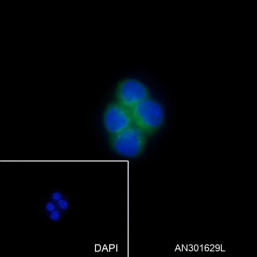 Recombinant PI3 Kinase p85 alpha Monoclonal Antibody - small - 3