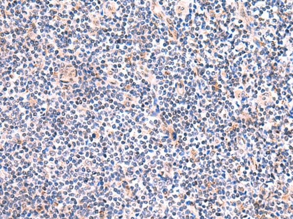 Immunohistochemistry of paraffin-embedded Human tonsil tissue  using FUCA2 Polyclonal Antibody at dilution of 1:80(?200)