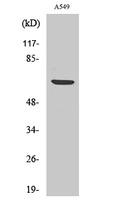 Western Blot analysis of A549 cells using Phospho-p70 S6 kinase alpha (Ser447) Polyclonal Antibody at dilution of 1:1000