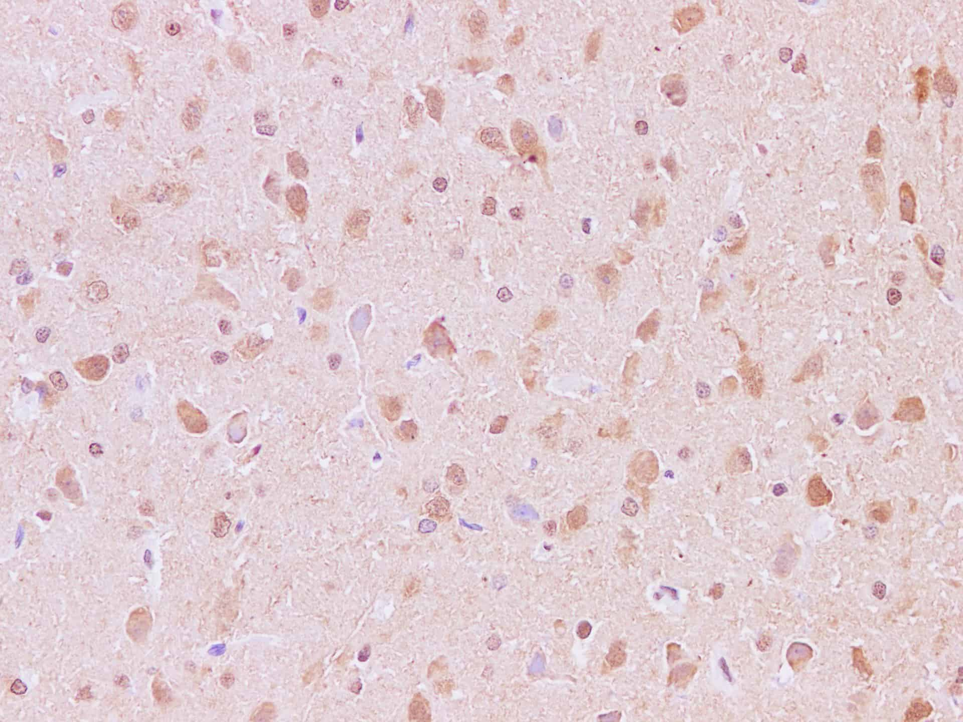 Immunohistochemistry of paraffin-embedded Rat brain using JNK2 Polyclonal Antibody at dilution of 1:200