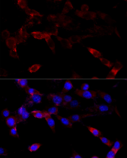 Immunofluorescence analysis of NIH/3T3 cells using CYP1B1 Polyclonal Antibody at dilution of 1:100 (40x lens). Blue: DAPI for nuclear staining.