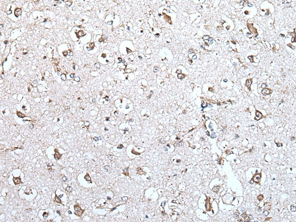 Immunohistochemistry of paraffin-embedded Human brain tissue  using MCM10 Polyclonal Antibody at dilution of 1:45(?200)