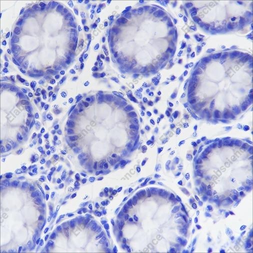 Recombinant Napsin A Monoclonal Antibody - 1