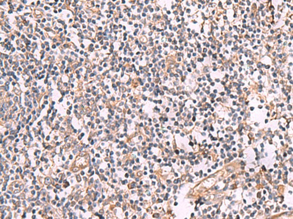 Immunohistochemistry of paraffin-embedded Human tonsil tissue  using SLC12A5 Polyclonal Antibody at dilution of 1:50(?200)