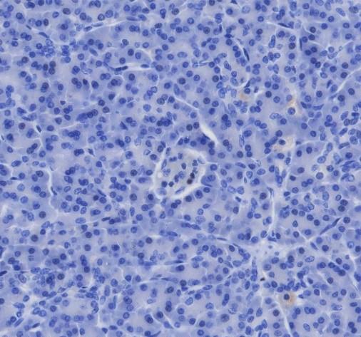 Recombinant GATA1 Monoclonal Antibody - small - 3