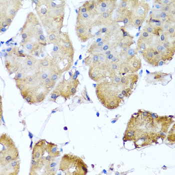 Immunohistochemistry of paraffin-embedded human stomach using NIN Polyclonal Antibody at dilution of 1:100 (40x lens).Perform microwave antigen retrieval with 10 mM PBS buffer pH 7.2 before commencing with IHC staining protocol.