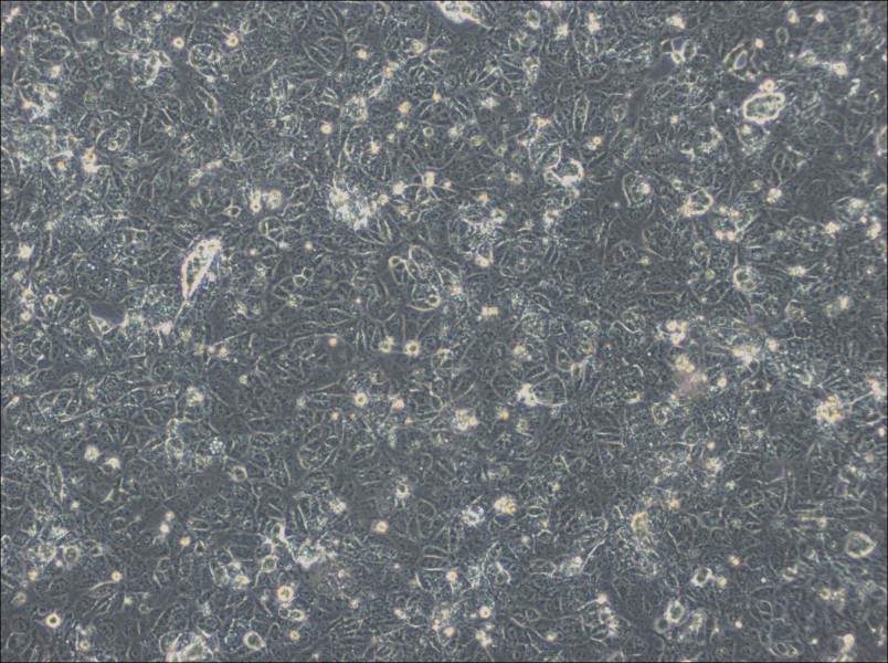 NTERA-2 Cell Complete Medium - 3