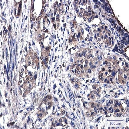 Recombinant Annexin 4 Monoclonal Antibody - 4