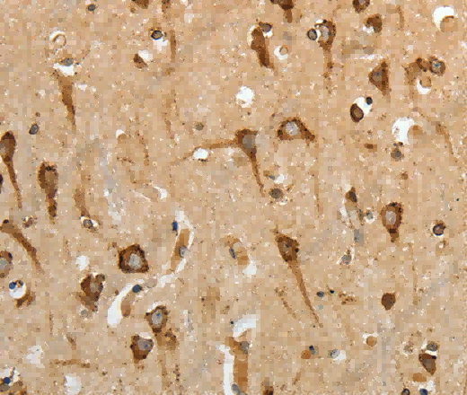 HSP90B1 Polyclonal Antibody - 2