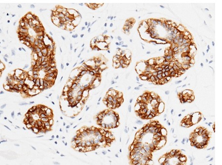 TROP2/TACSTD2 Monoclonal Antibody - small - 3