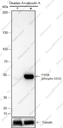 Recombinant Phospho-PTP1B (Ser352) Monoclonal Antibody - 1