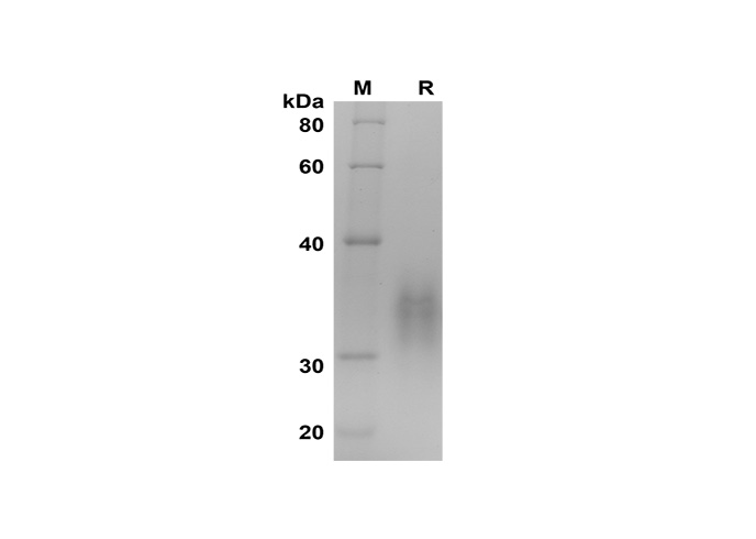 Recombinant mouse TGF-beta 2/TGFB2 Protein(His Tag)-产品推荐-1