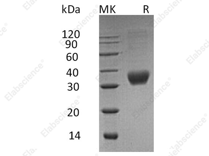 Recombinant Human Fas/CD95/TNFRSF6 Protein (His Tag) - 1