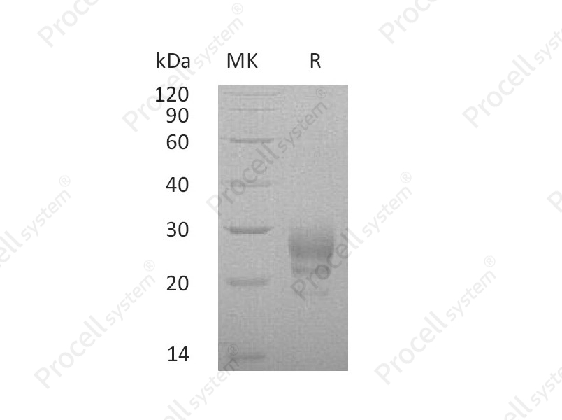IL-7 (C-6His), Human, Recombinant