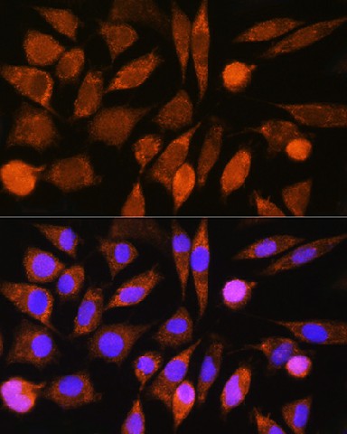 Immunofluorescence analysis of L929 cells using CHCHD7 Polyclonal Antibody at dilution of 1:100. Blue: DAPI for nuclear staining.