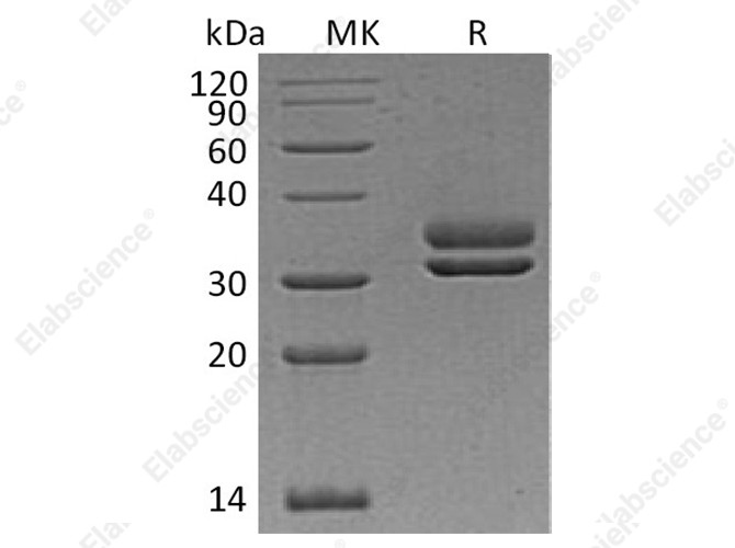 Recombinant Human CFHR2 Protein (His Tag) - 1