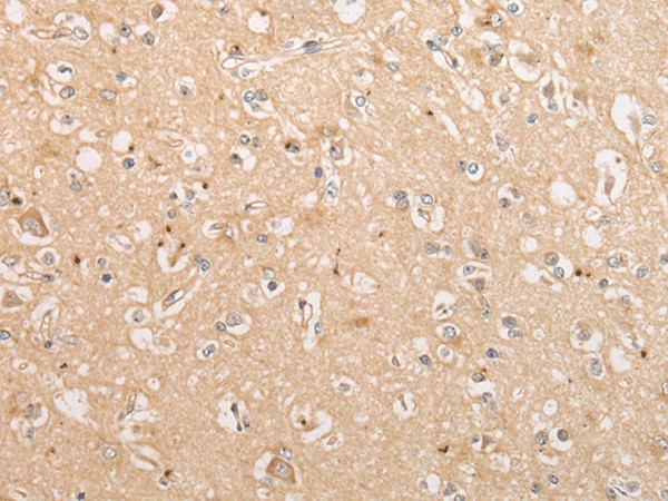 Immunohistochemistry of paraffin-embedded Human brain tissue  using C15orf40 Polyclonal Antibody at dilution of 1:30(?200)