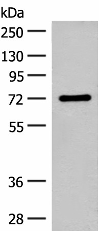 Western blot analysis of Rat brain tissue lysate  using SLC6A11 Polyclonal Antibody at dilution of 1:500