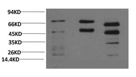 Western Blot analysis of 1) Hela, 2) Rat brain, 3) Mouse brain with Phosphoserine Monoclonal Antibody at dilution of 1:2000