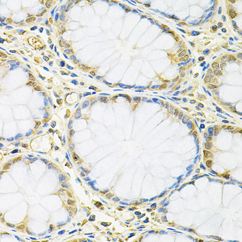 Immunohistochemistry of paraffin-embedded human colon using FMRP Polyclonal antibody at dilution of 1:100 (40x lens).Perform microwave antigen retrieval with 10 mM PBS buffer pH 7.2 before commencing with IHC staining protocol.